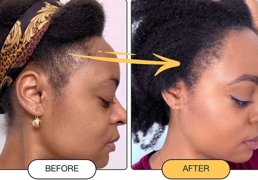 Batana Oil ¨C Nourished Roots, Fuller-Looking Hair