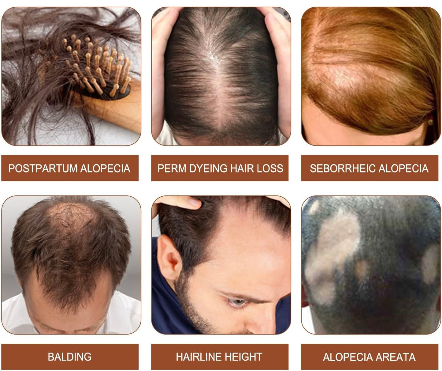 Batana Oil ¨C Nourished Roots, Fuller-Looking Hair